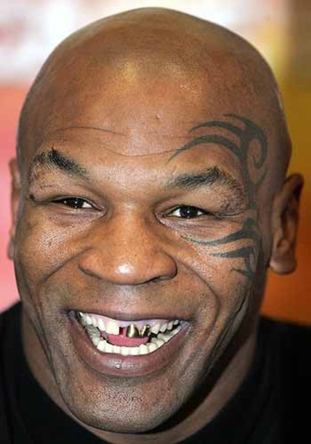 Tyson