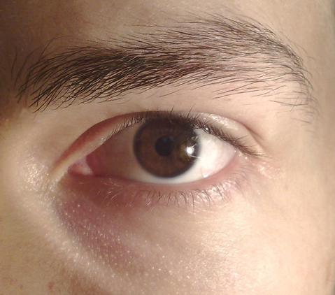My Eye