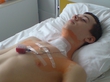 Posle operacii ^^