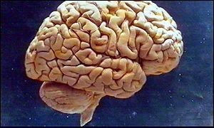 что такое мозг?