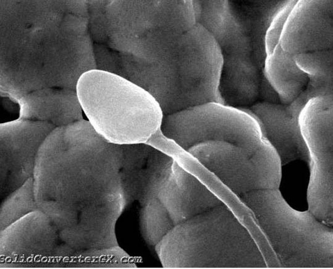 Mikroskopisks attēls - kāds visraksturīgākais tas varētu būt?