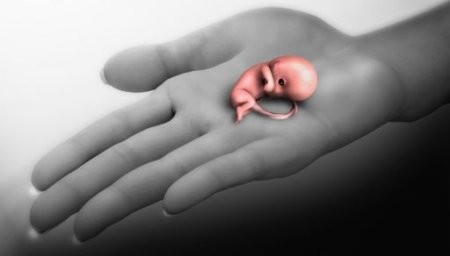 ko lai parada cilvēkam kas domā taisīt abortu?