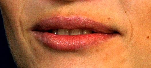 Покажите некрасивые губы (не половые)?